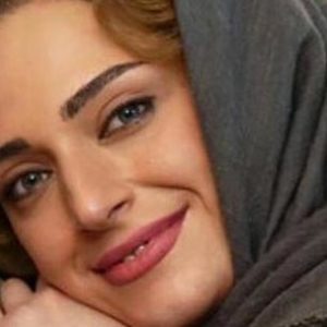 فیلم | ماجرای دماغ دردسرساز بازیگر زن مهران مدیری: می گفتند باید دماغت را عمل کنی!